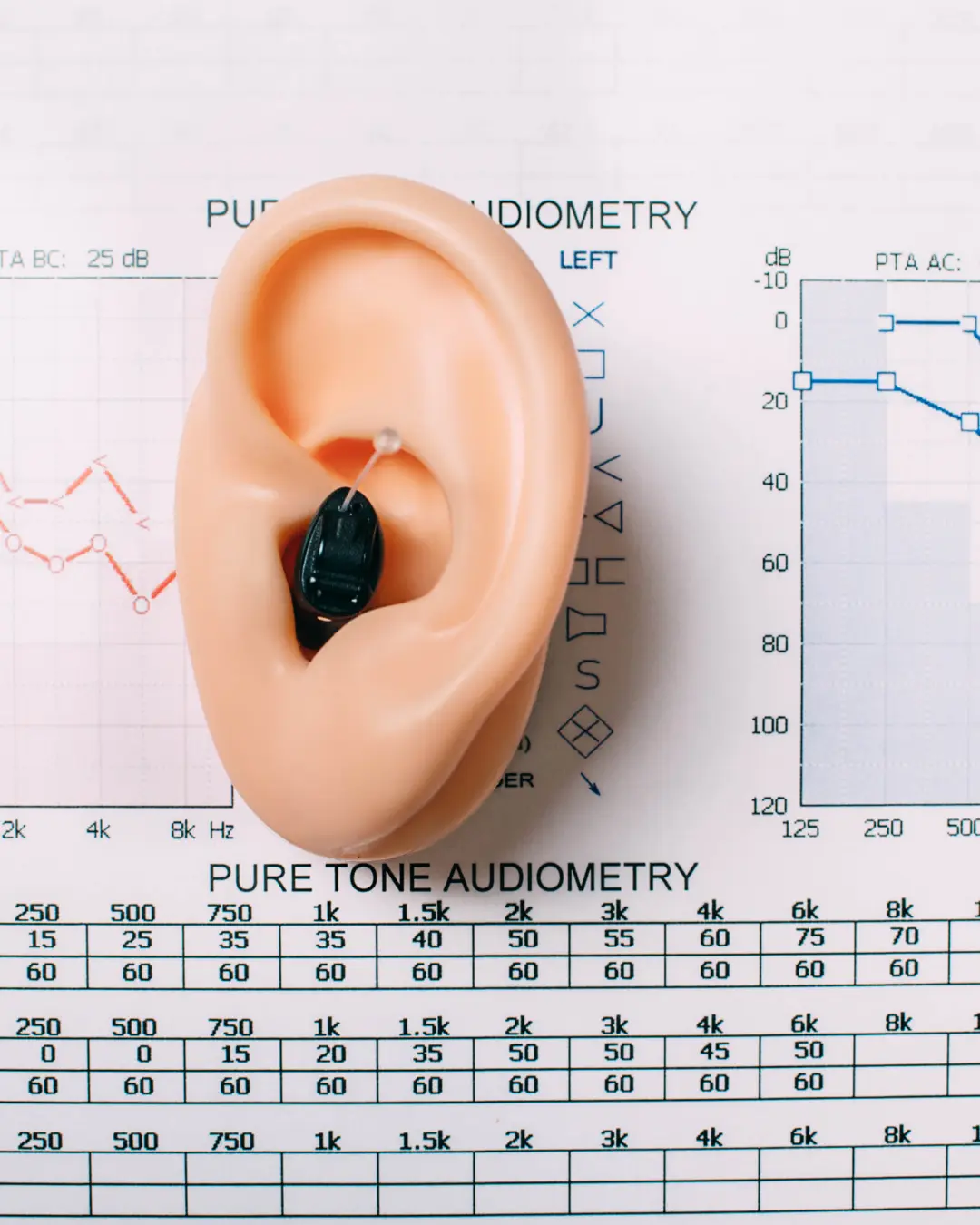Herkese Aynı İşitme Cihazı Olur Mu? Neden Olmaz? 