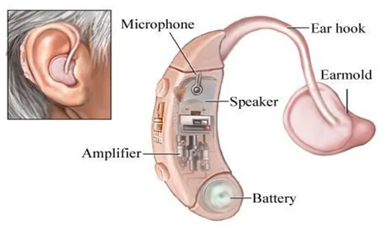 İşitme Cihazları Nasıl Çalışır?